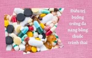 dieu-tri-buong-trung-da-nang-thuoc-tranh-thai-n-sqc