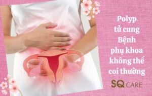 Dấu hiệu polyp tử cung